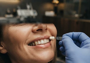 Diseño de Sonrisa