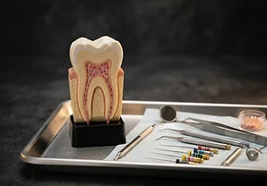 Endodoncia