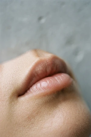 Lip Filler treatment at Magnafi Aesthetics