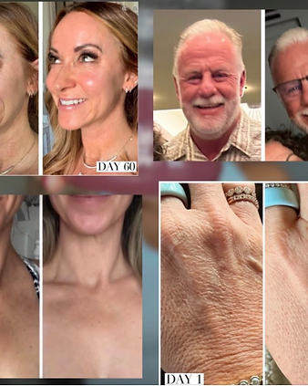 Day 1 to Day 60 — visible renewal