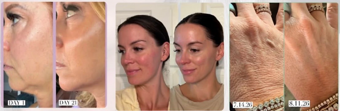 Before-and-after results from the MAKE Wellness Precision Skincare System