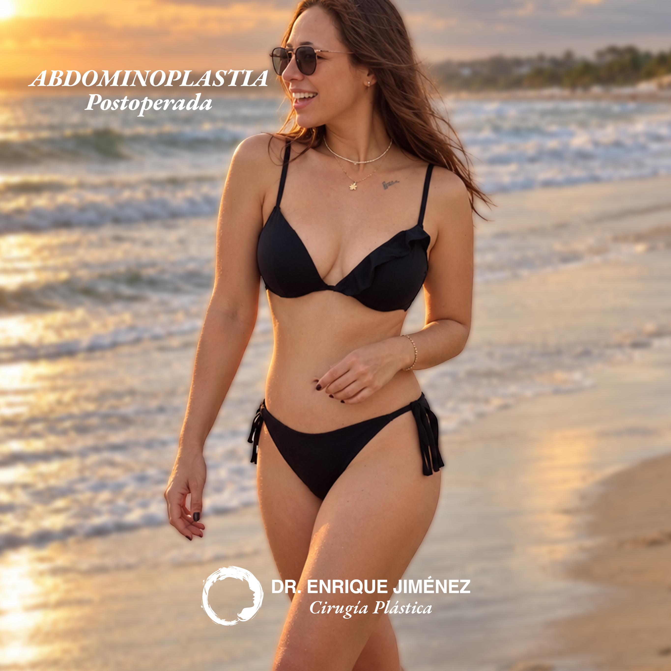 Abdominoplastia — Postoperada 1