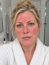 Emma — Week 0, before using the serum