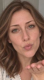 Rachel — Week 12, after using the serum