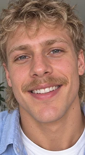 Ryan — Week 12, after using the serum