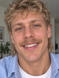 Ryan — Week 12, after using the serum
