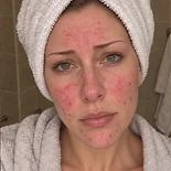Rachel, Week 0