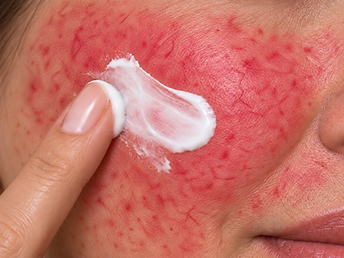 Calms Redness on Contact