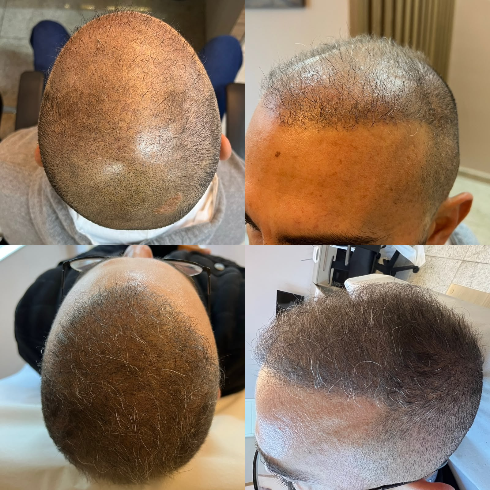 Resultado antes e depois 3
