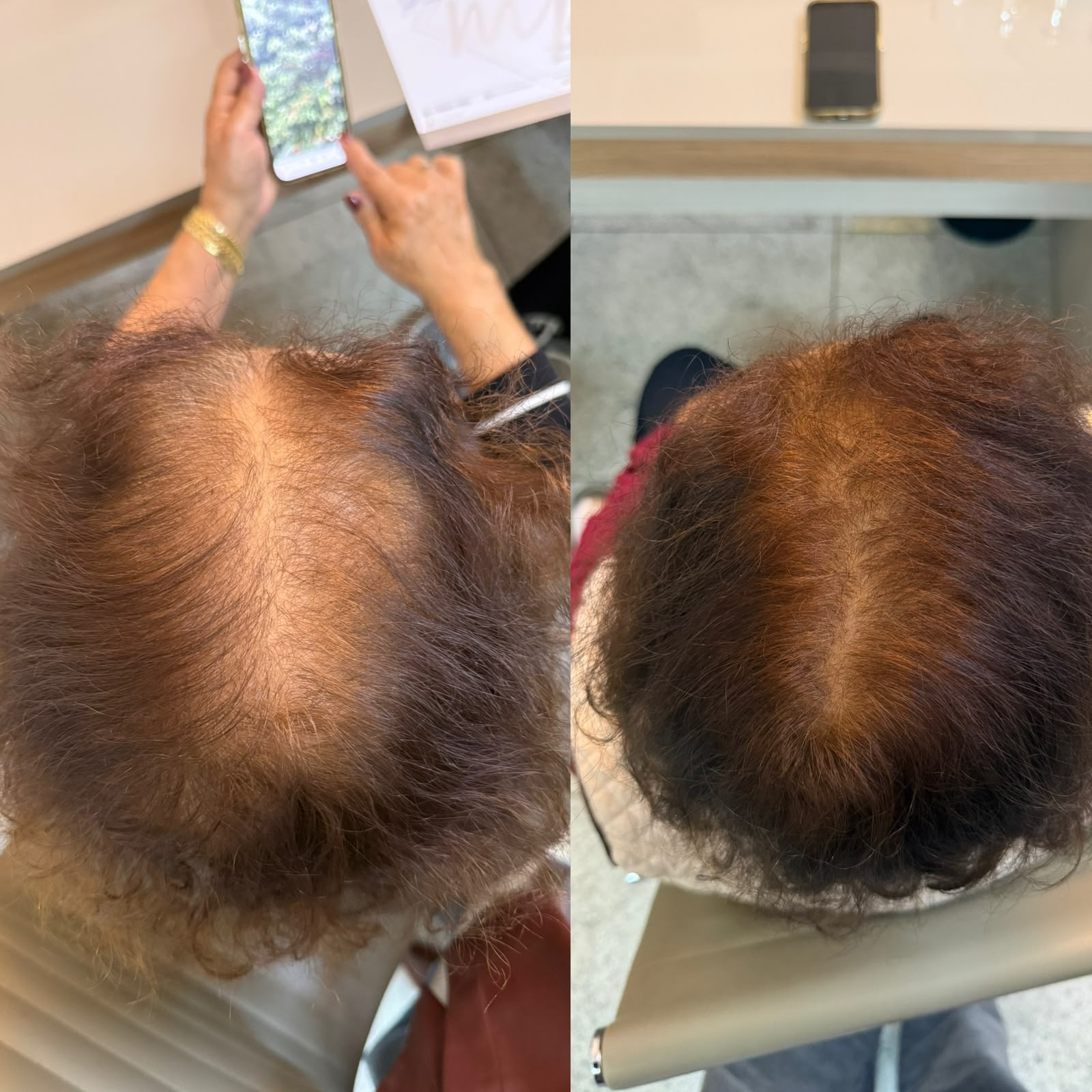 Resultado antes e depois 5