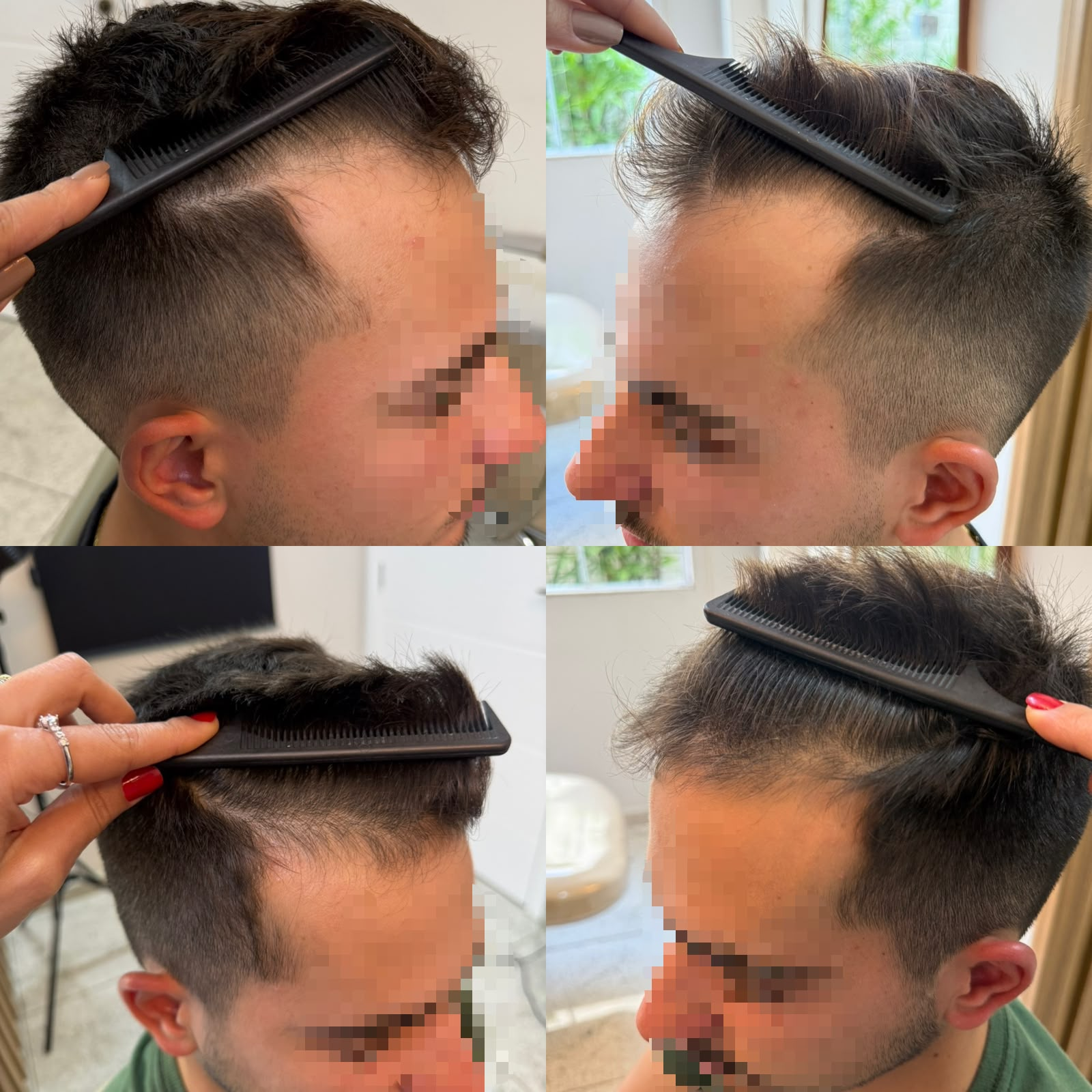 Resultado antes e depois 7