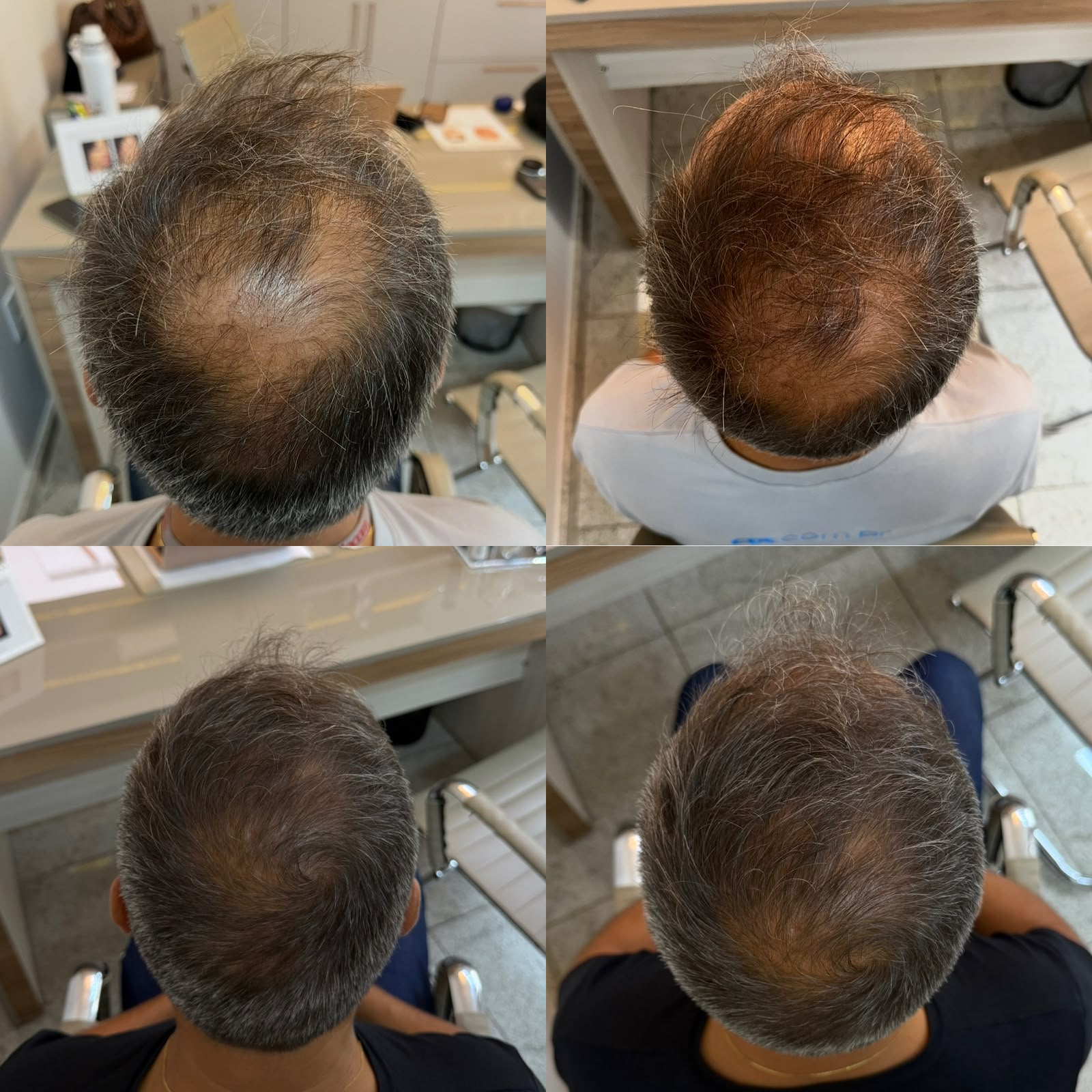 Resultado antes e depois 2