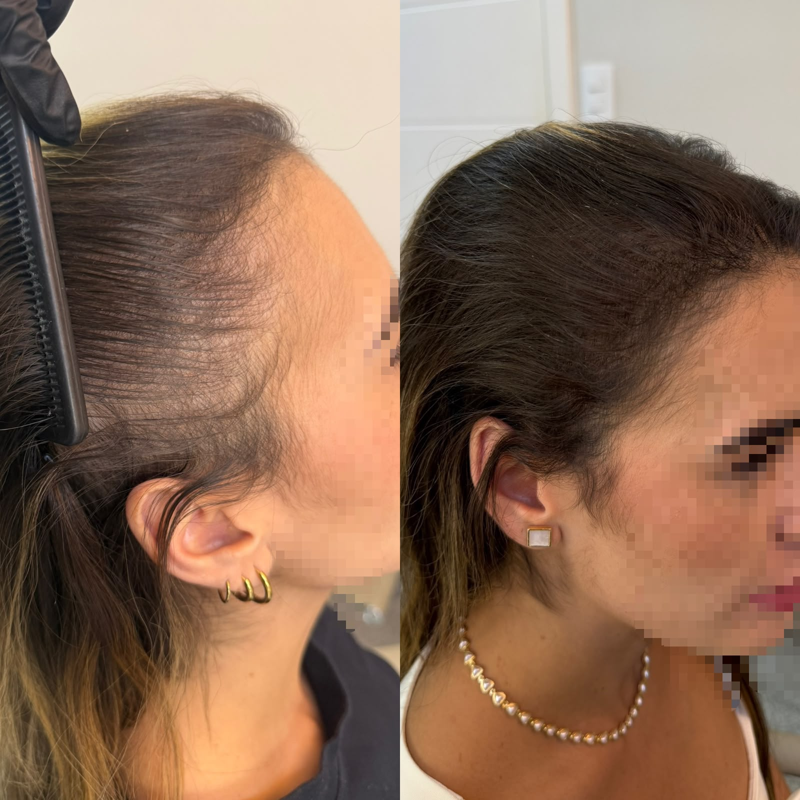 Resultado antes e depois 6