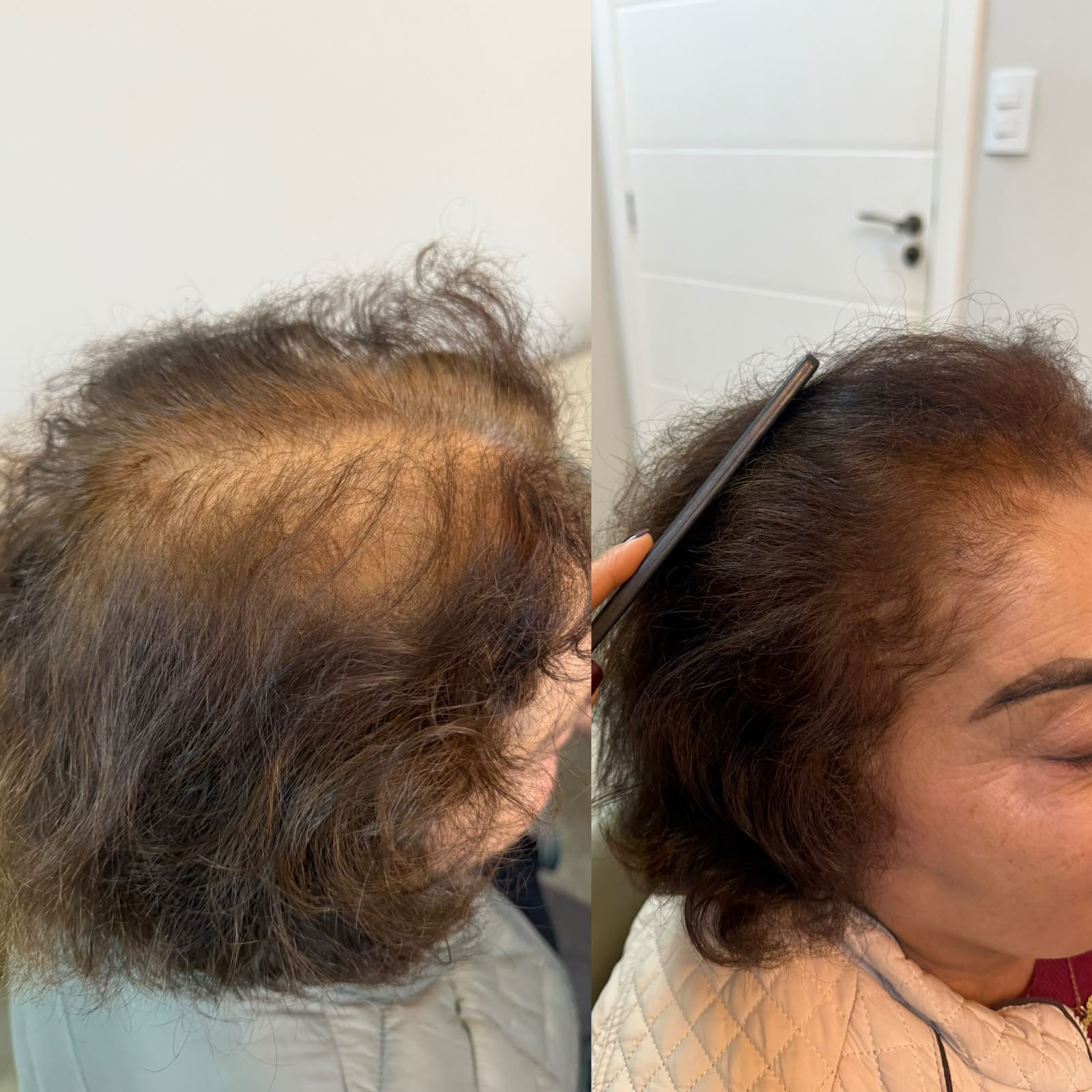 Resultado antes e depois 4