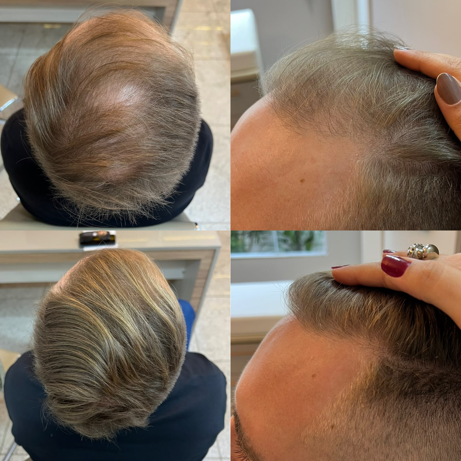 Resultado antes e depois 1