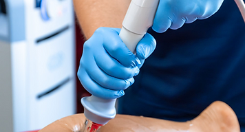shockwave treatment in progress