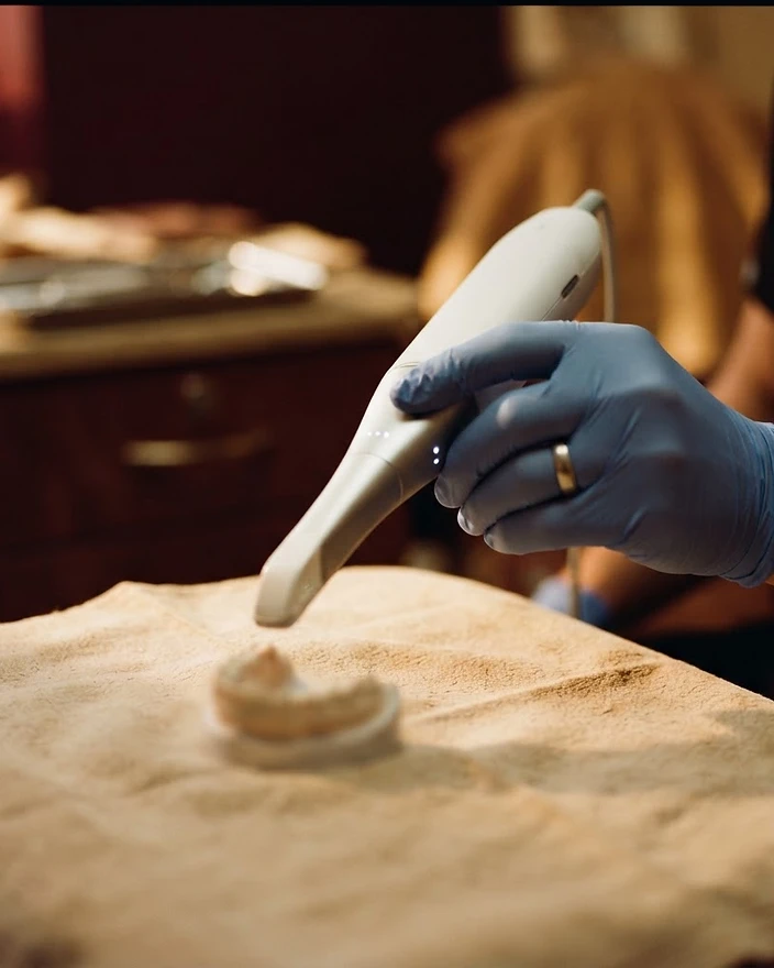 Digital intraoral scanning