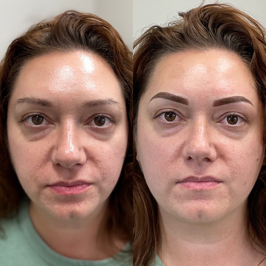 Before and after — Custom Brows by Glenda Vega