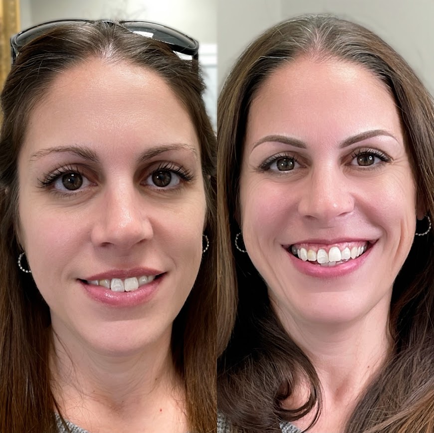 Before and after — Powder Brows by Glenda Vega