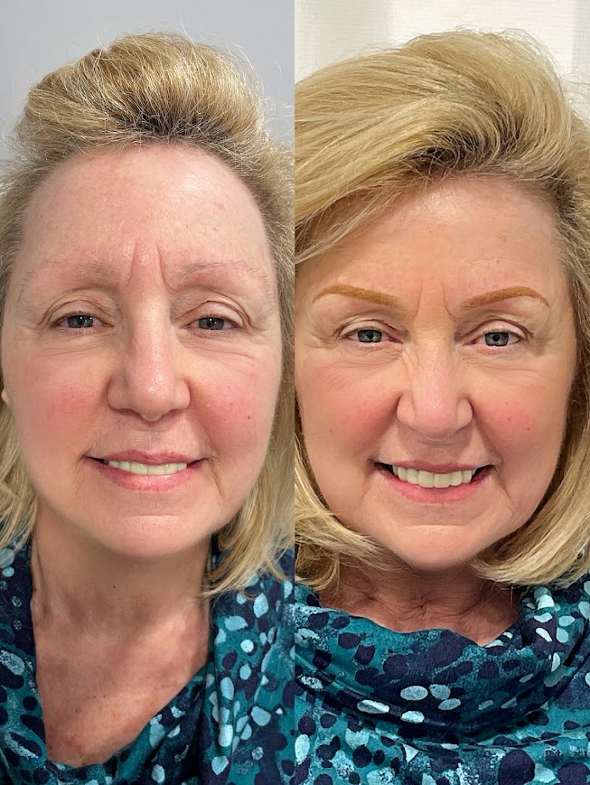 Before and after — Custom Brows by Glenda Vega