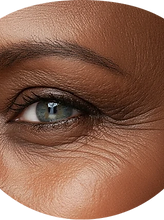 Texture & Fine lines