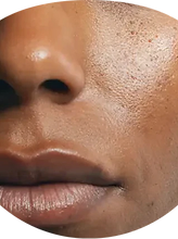 Dull, tired-looking skin