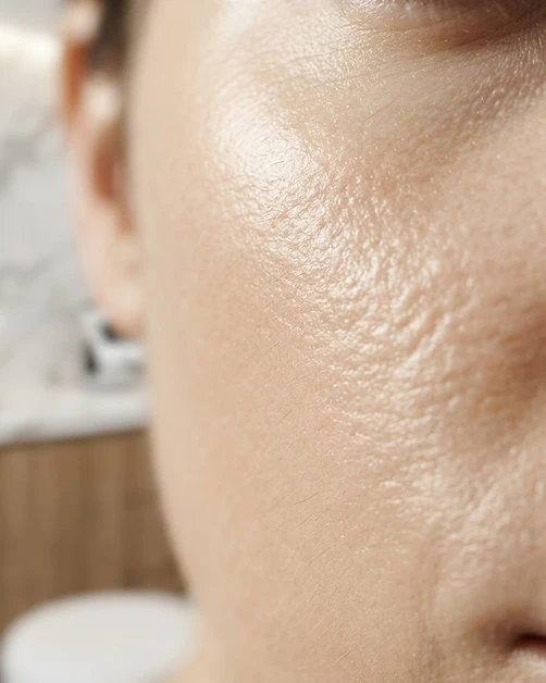 Close-up of healthy, luminous skin texture
