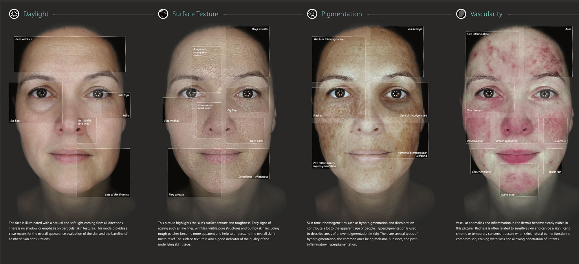 Observ 520X skin analysis modes: Daylight, Surface Texture, Pigmentation and Vascularity