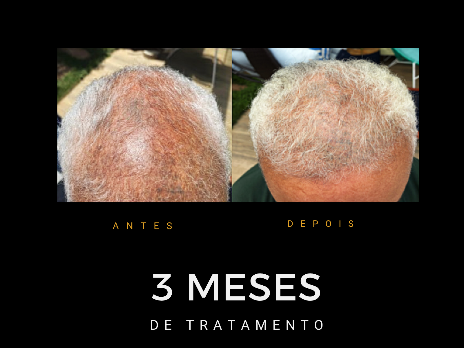 Antes e depois do protocolo