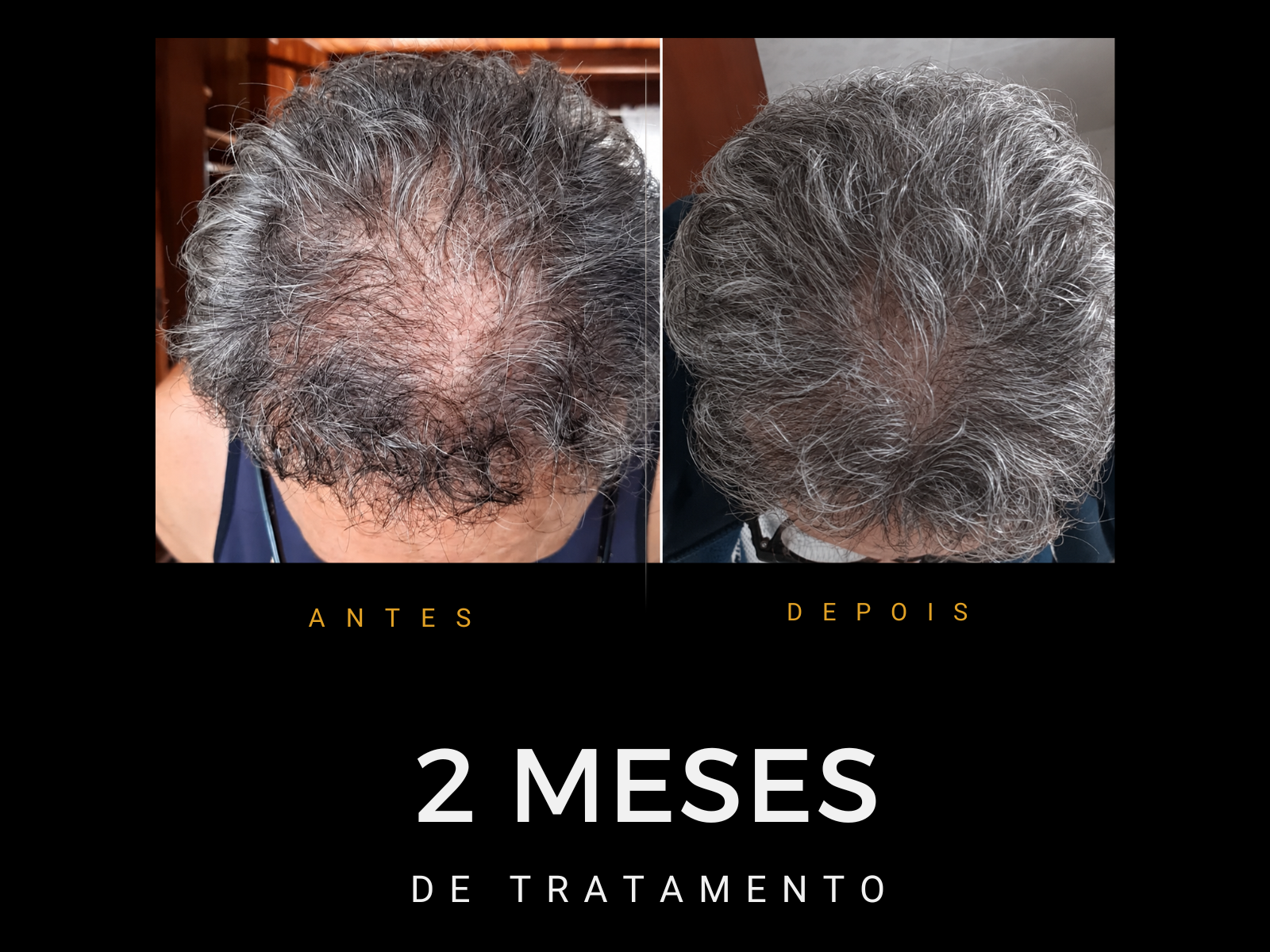 Antes e depois do protocolo
