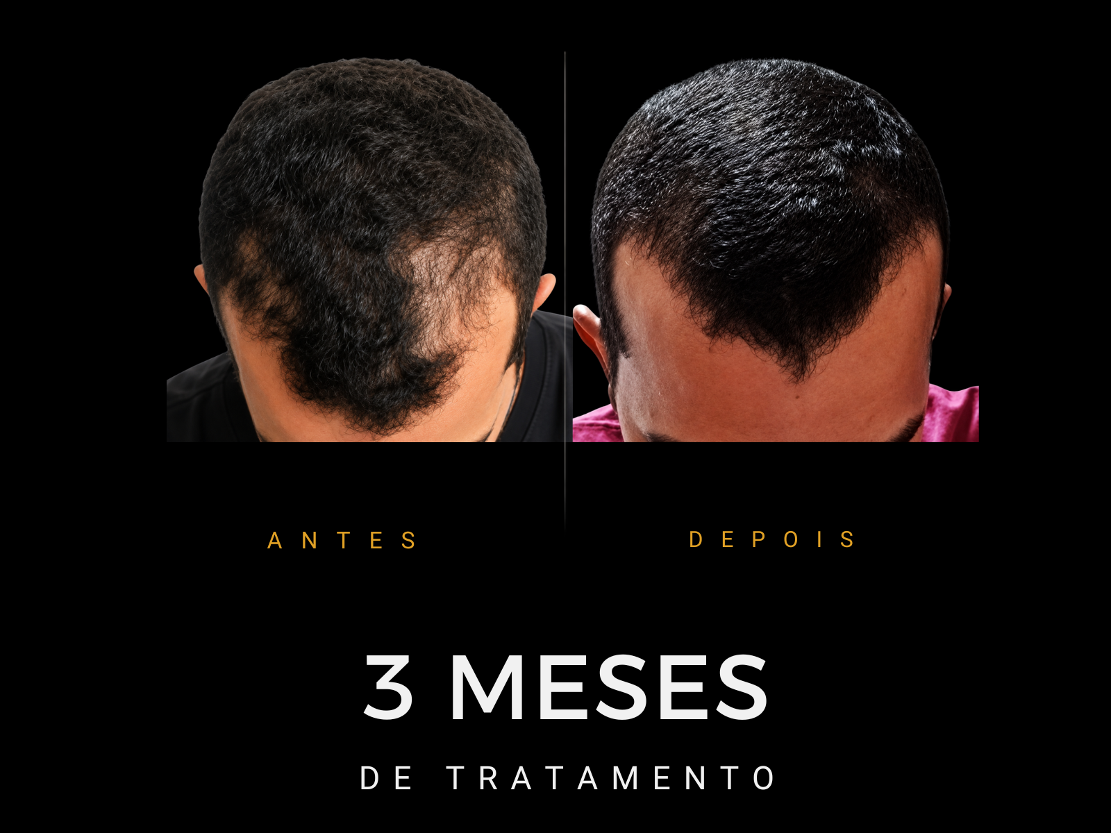 Antes e depois do protocolo