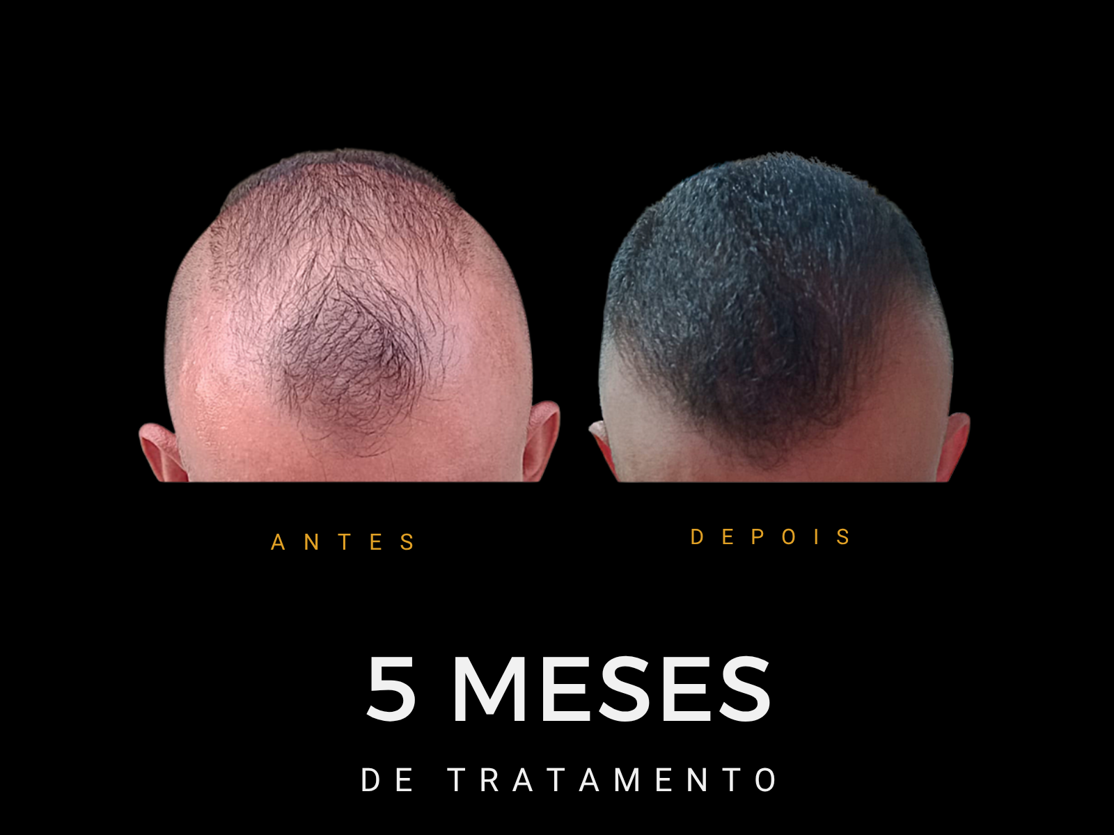 Antes e depois do protocolo