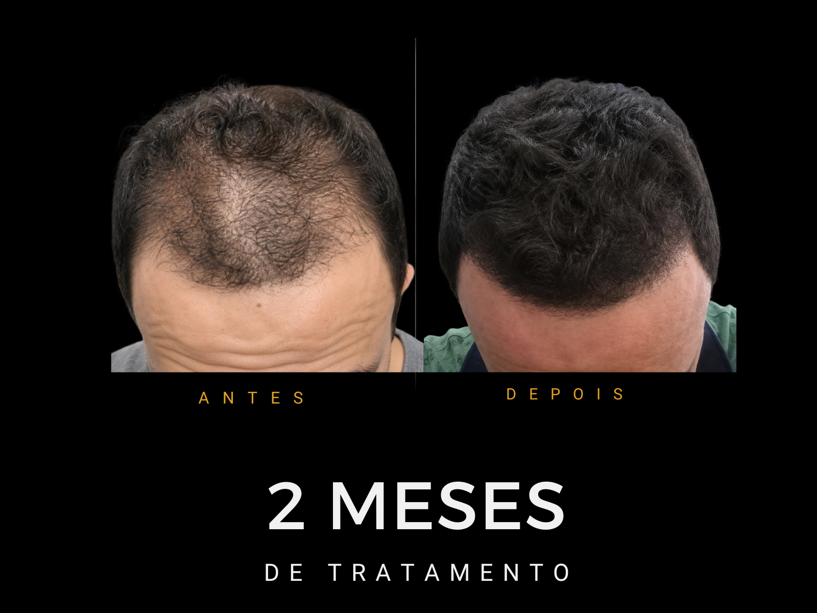 Antes e depois do protocolo