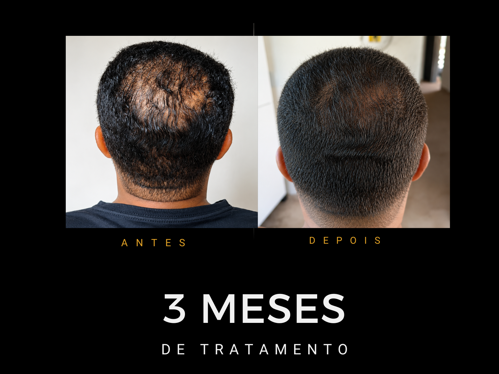 Antes e depois do protocolo