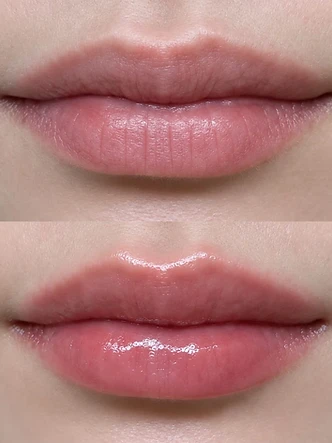 Lips beauty work by SW Beauty — Pink lip laser — before & after