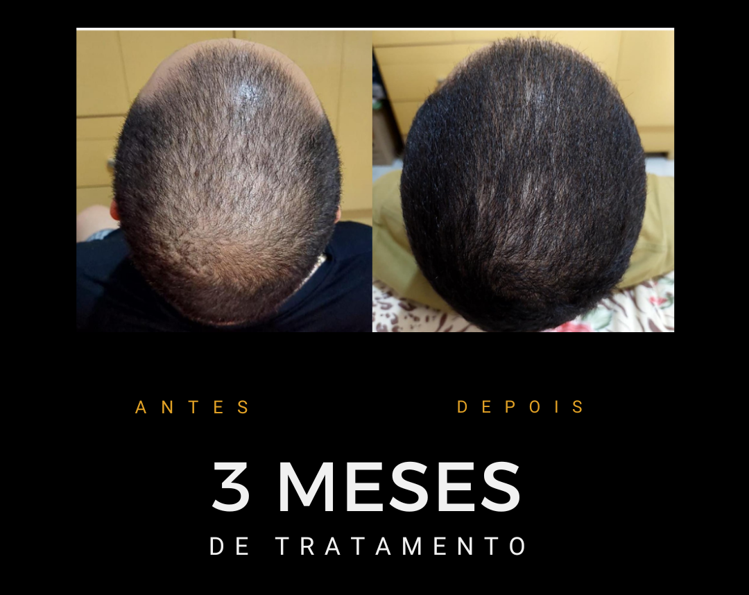 Antes e depois do protocolo