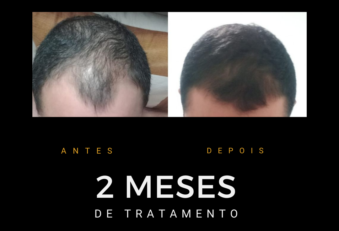 Antes e depois do protocolo