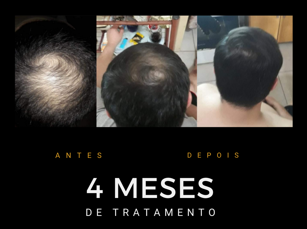 Antes e depois do protocolo