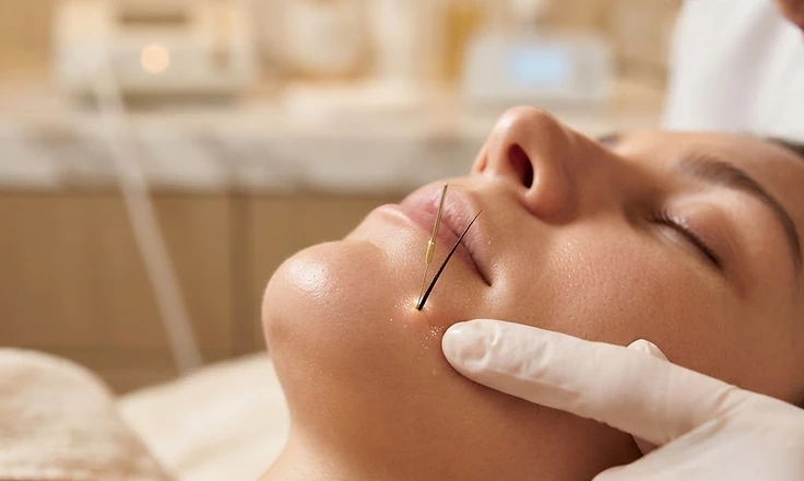 Electrolysis