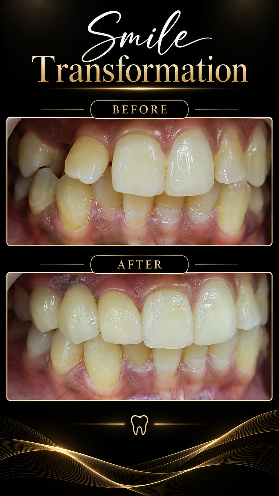 Before and after Smile Transformation