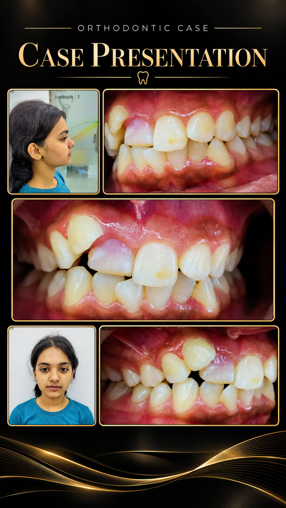 Before and after Orthodontic Case Presentation