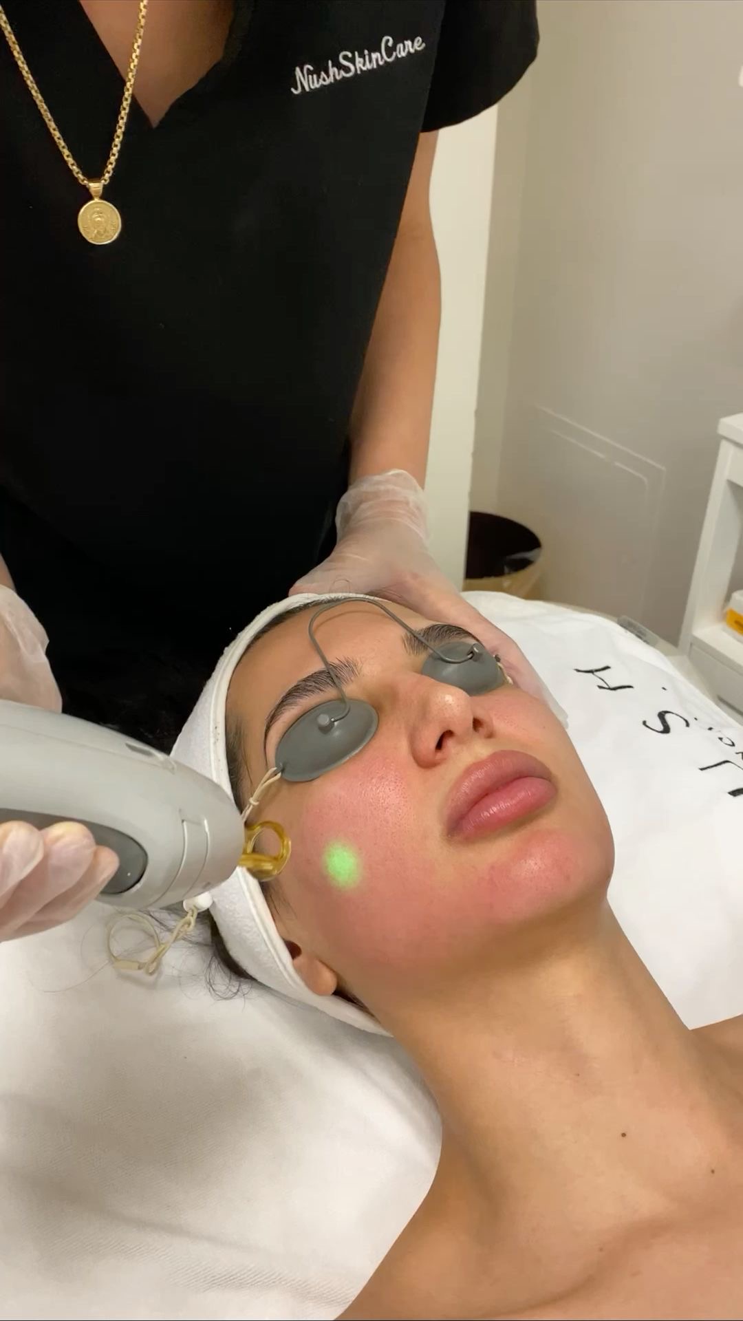 Laser, Épilation définitive