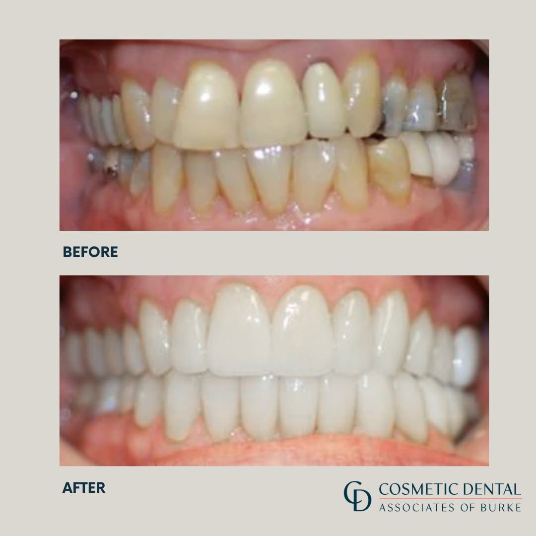 Before and after patient result 2