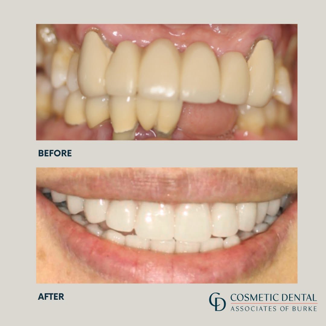 Before and after patient result 3