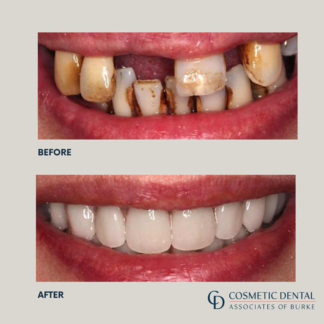 Before and after patient result 1