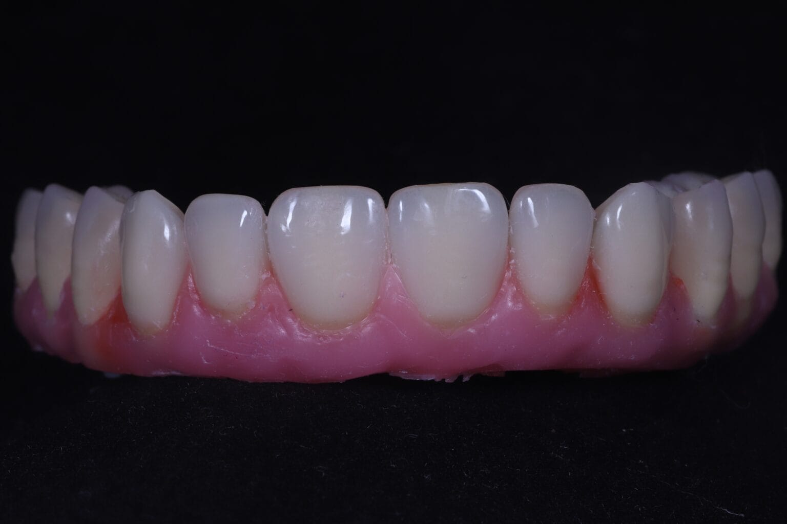 Rehabilitación Oral 1