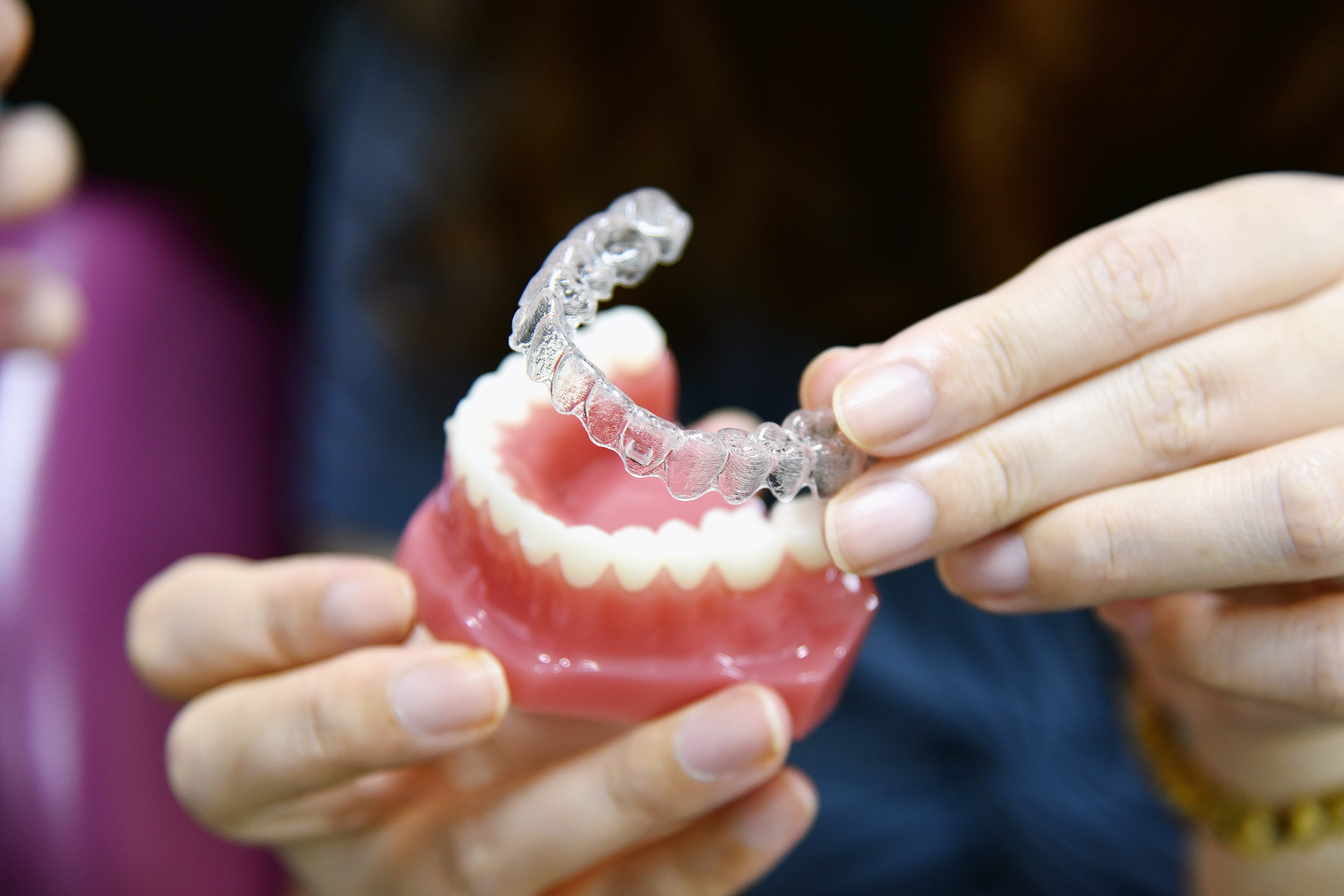 Invisalign clear aligner tray held over a dental model