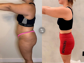 Antes e depois de aluna 4