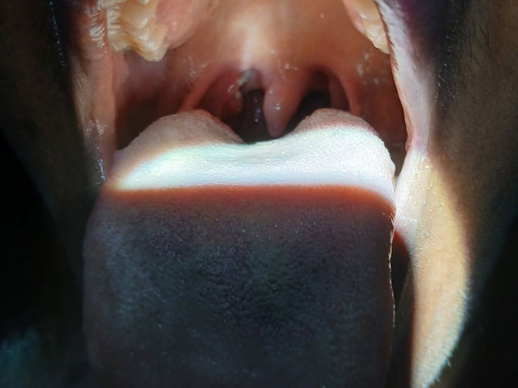 Throat and oral cavity assessment