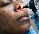 Managing Sinusitis: What You Can Do at Home